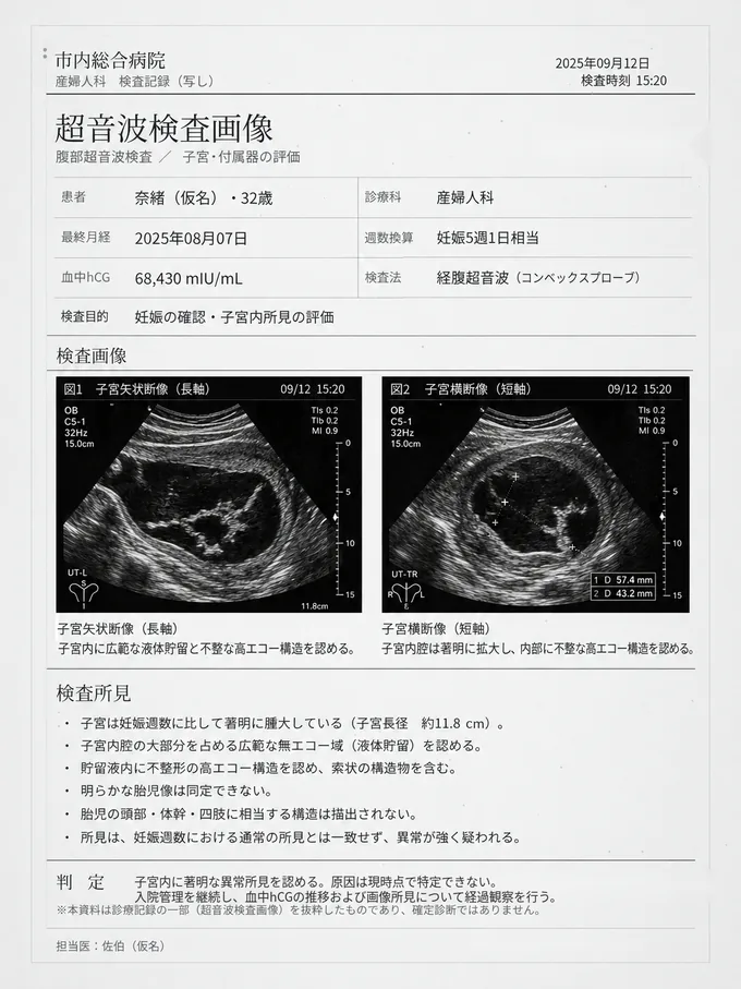 2025年9月12日15時20分の超音波検査報告書。検査値と2断面の超音波画像、子宮内の異常所見が記載されている。